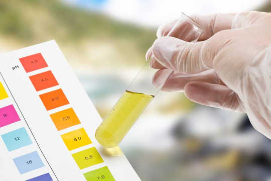 What Can Your Doctor Tell From Your Urine?